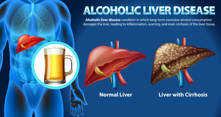 How alcohol affects the liver and why it matters